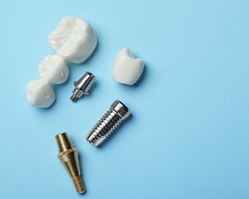 Bird’s eye view of dental implants, abutment, crown, and bridge with light blue background