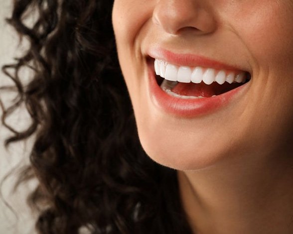 Close-up of woman’s smile with perfect teeth