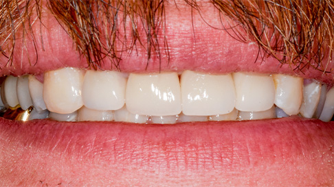 Healthy white smile after cosmetic dentistry