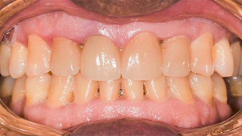 Healthy white smile after cosmetic dentistry