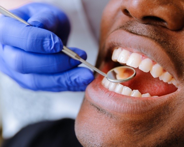 Dentist examining smile after tooth colored filling restorative dentistry