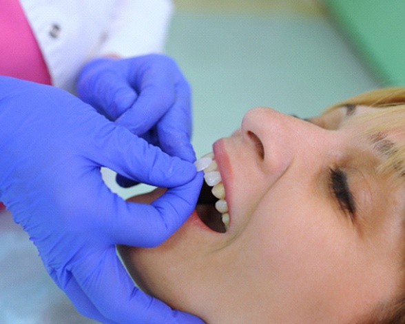 woman getting veneers in Pacoima