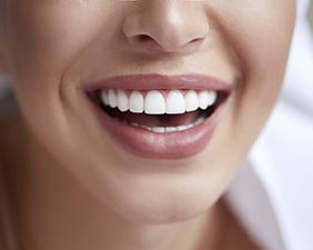 closeup smiling for cost of veneers in Pacoima 
