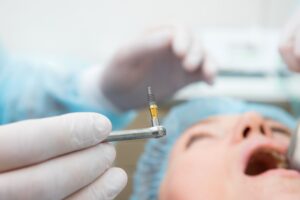 Closeup of gloved hands holding dental implant during patient's procedure