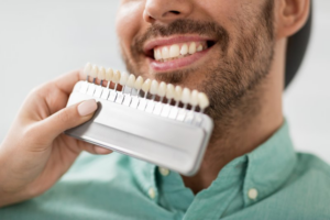Dentist comparing a set of dental veneers to a patient’s natural teeth